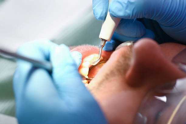 Best Emergency Denture Repair in Ellsworth, KS