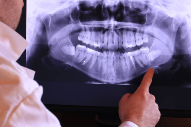 Best Emergency Root Canal Therapy in Ellsworth, KS