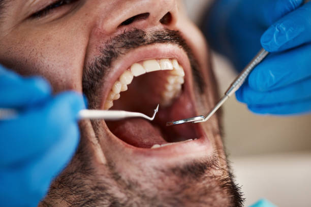 Best After-Hours Dental Care in Ellsworth, KS