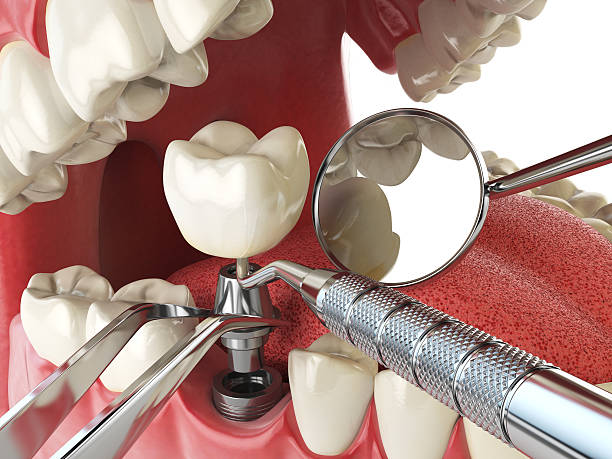 Trusted KS Emergency Dental Service Experts